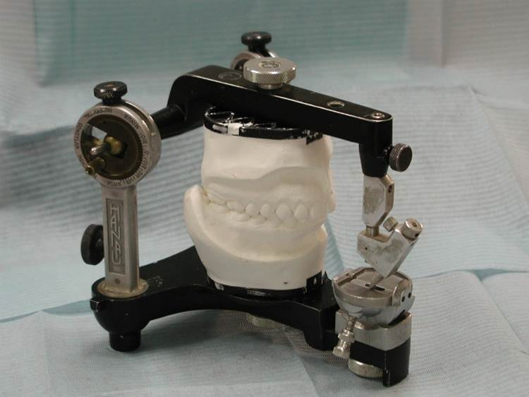 中心位で半調節咬合器に装着された模型